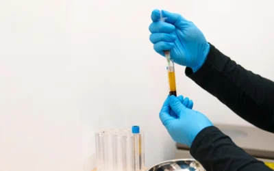 Reparación de tejidos blandos con tratamientos regenerativos: PRP, factores de crecimiento y fisioterapia deportiva